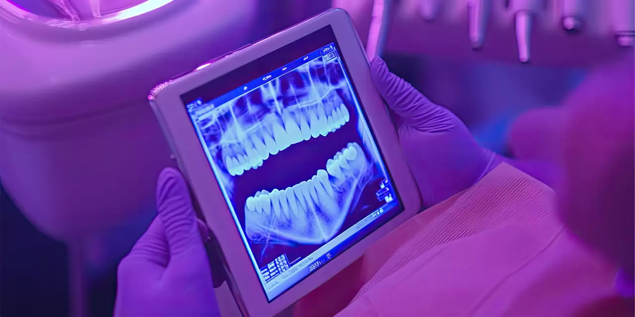 Escaneamento Intraoral x Moldagem Tradicional